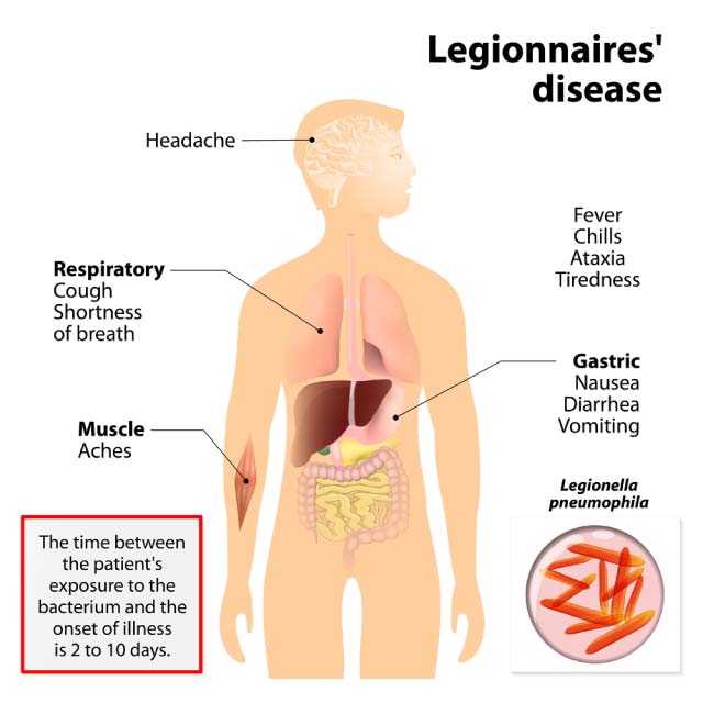 symptoms of legionnaires' disease graphic