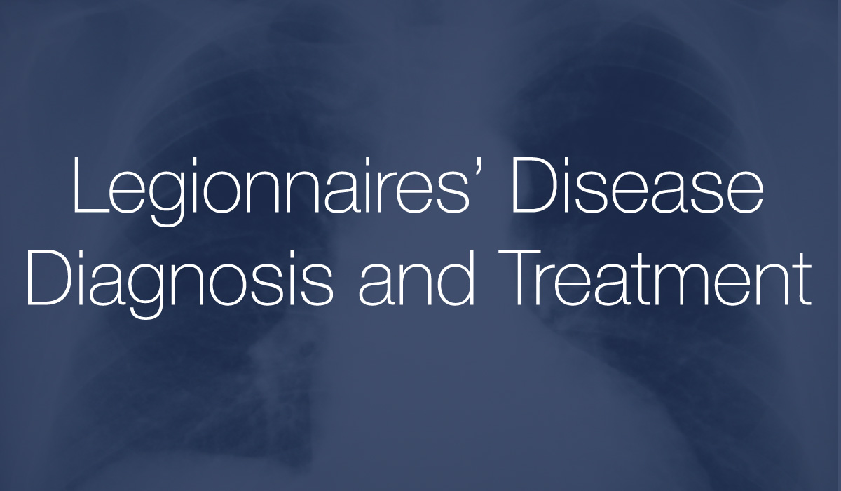 legionnaires-disease-diagnosis-and-treatment