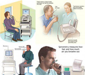 Diagnosing Legionnaires Disease With Pulmonary Function Test