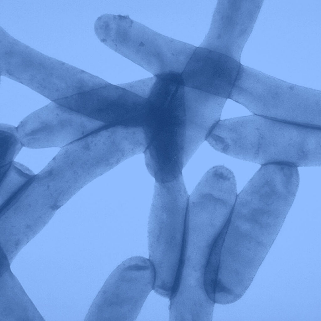 LEARN ABOUT LEGIONNAIRES DISEASE visual data 6